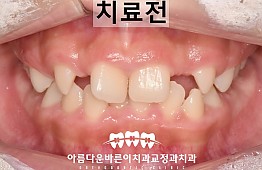 수술전