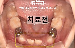 수술전