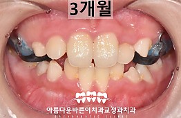 수술후