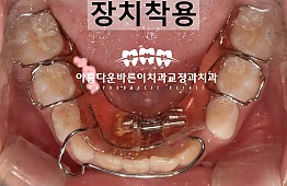 수술후