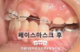 수술후