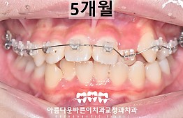 수술후