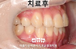 수술후