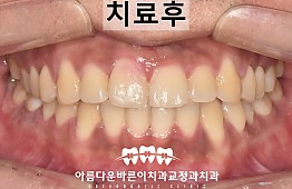 수술후