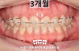 수술후