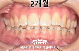 수술후