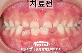 수술전
