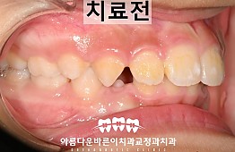 수술전