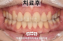 수술후