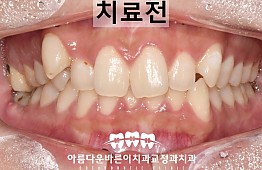 수술전