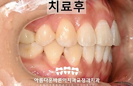 수술후