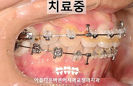 수술후