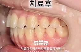 수술후