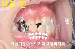 수술전