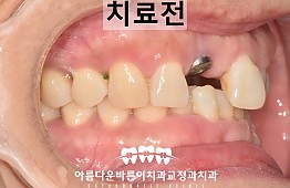 수술전