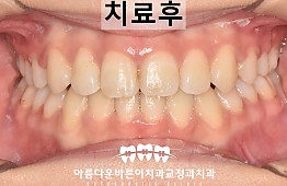 수술후