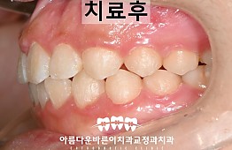 수술후