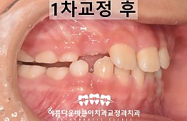 수술후