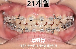 수술후