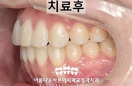 수술후