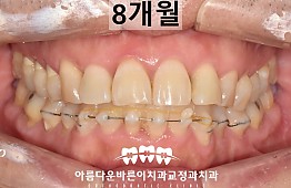 수술후