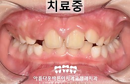 수술후
