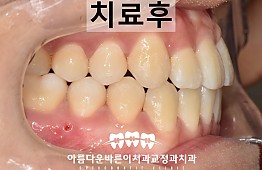 수술후