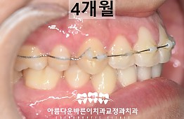 수술후