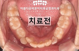 수술전