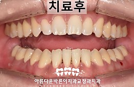 수술후
