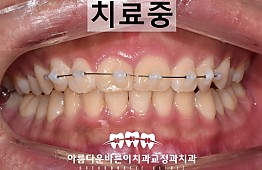 수술후