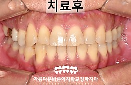 수술후