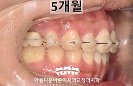 수술후