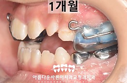 수술후