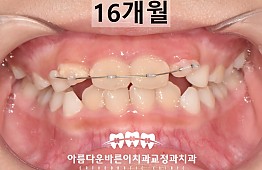 수술후