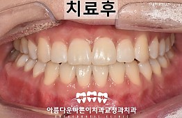 수술후