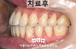 수술후