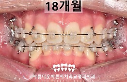 수술후