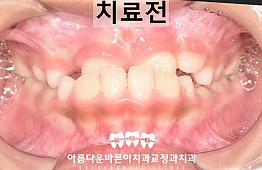 수술전