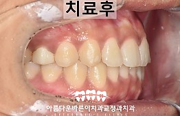 수술후