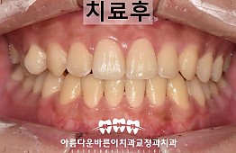 수술후