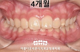 수술후