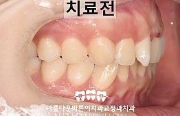 수술전