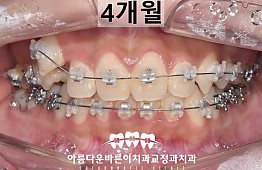 수술후