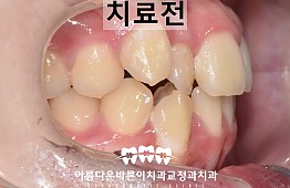 수술전