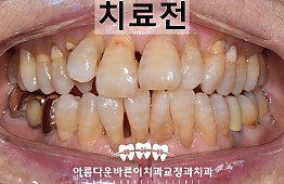 수술전