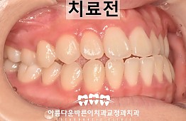 수술전