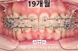 수술후