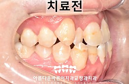 수술전