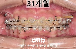 수술후